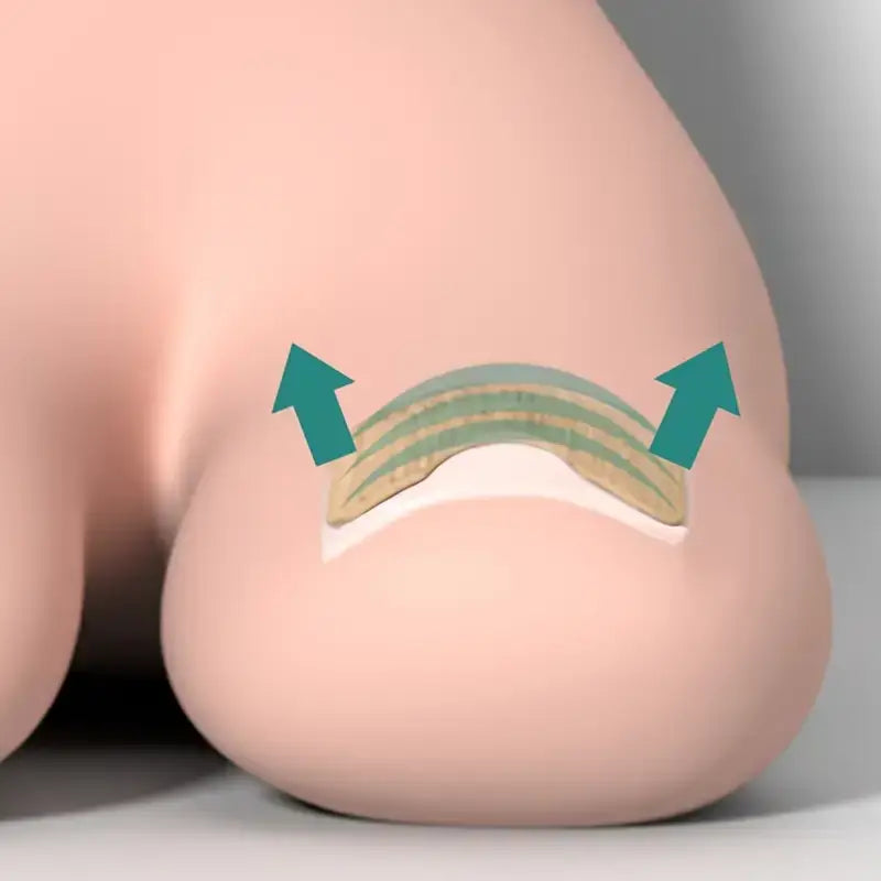 Ingrown Toenail Patches (100 pcs)