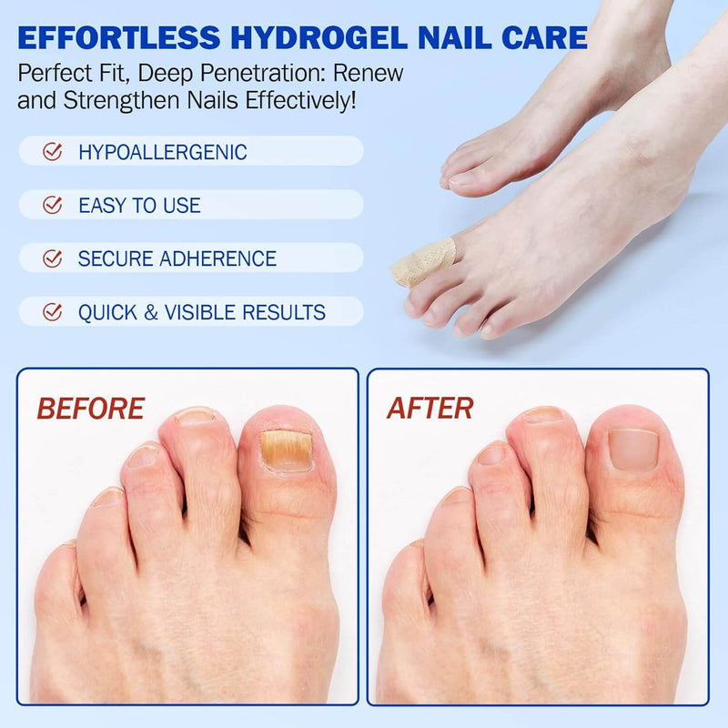 #1 Fungal Nail Patches
