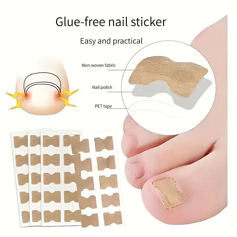 Ingrown Toenail Patches (100 pcs)