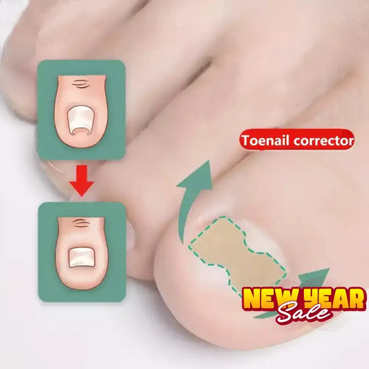 Ingrown Toenail Patches (100 Pcs)